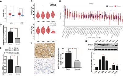 SOD1 Promotes Cell Proliferation and Metastasis in Non-small Cell Lung Cancer via an miR-409-3p/SOD1/SETDB1 Epigenetic Regulatory <mark class="highlighted">Feedforward Loop</mark>